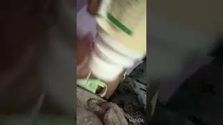 Tummy Roll on 100%ayurvedic to make hing and saunf oil  # #ayurvedicsolutions #yt #babytips #viral