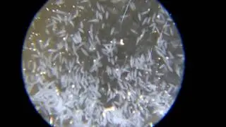 ゾウリムシうじゃうじゃ Paramecium (slipper animalcule)