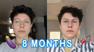 8 Months on T Update | FTM Trans Guy