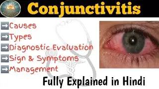 Conjunctivitis in Hindi | Types , causes , Sign & Symptoms , Management 