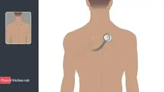 Pleural friction rub