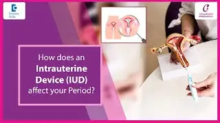 Copper T Insertion & Removal | Pain, Bleeding & Side Effects -Dr. Lakshmi Kalbande | Doctors' Circle