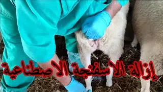 إزالة الاسفنجة الاصطناعية مع التلقيح الهرمونات استعدادا لتلقيح والحمد لله النتيجة ممتازة