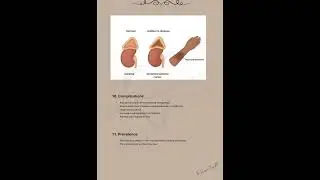 📌Case Study: Addison&rsquo;s Disease |Causes, Symptoms & Treatment Explained|KPK Physical Therapy #reels