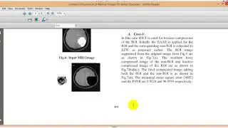 LOSSLESS COMPRESSION OF MEDICAL IMAGES FOR BETTER DIAGNOSIS|ieee 2017 projects at bangalore