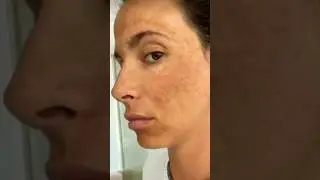 Mulethi powder face pack for pigmentation#skincare#shortvideo#ytshort