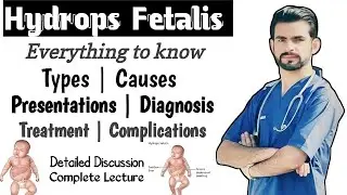 Hydrops Fetalis || causes, types, management, complications