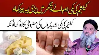 Calciam KI Kami Ka elaj | Calciam Deficiency Treatment | Dr Sharafat Ali