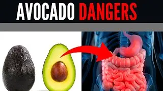 8 CRITICAL AVOCADO Mistakes You're Making Right Now
