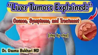&ldquo;Liver Tumors Explained: Causes, Symptoms, and Treatment Options&rdquo;
