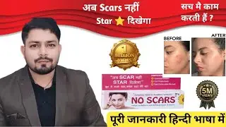 No Scars Cream Review | How to use no Scars Cream फायदे और नुकसान #noscars 