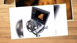 3d/4d sonography. Level 2 sonography. TIFFA scan. Anomalies scan. Second trimester ultrasound.