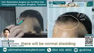 Is shock loss scary after hair transplantation? Will hair grow?