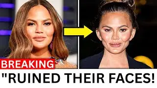 8 Hollywood Stars RUINED By Buccal Fat Removal &mdash; Shocking Before & After