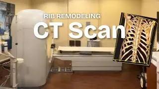 CT Scan for Rib Remodeling: What you need to know