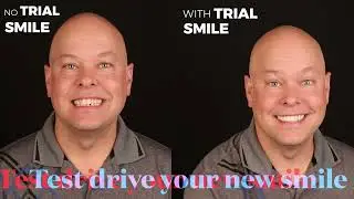 Trail Smile- test-drive before you commit and see how you look with a new smile.
