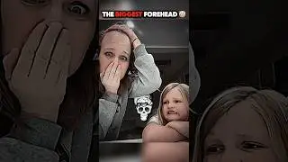The biggest forehead 💀 #edit #troll #trollface