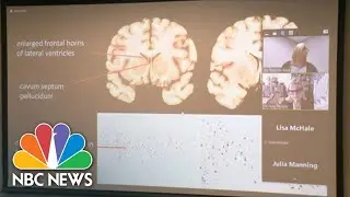 Officials Announce Former NFL Player Phillip Adams Had CTE At Time Of SC Shooting