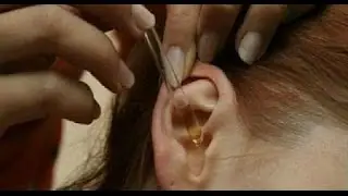 2 Drops Of This Magical And Natural Remedy Recovers 97% of Hearing Capability