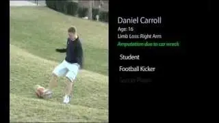Amputee Coalition Daniel Carroll 30 sec.mov