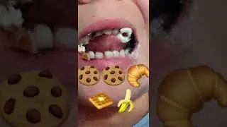 fodd Challenge