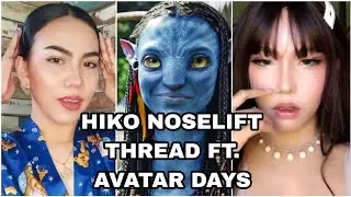 NON SURGICAL HIKO NOSE THREAD LIFT | RHINOSPLASTY