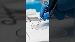 New Stem Cell Pancreas Ends Diabetes &mdash; Here&rsquo;s Why Americans Can&rsquo;t Get It