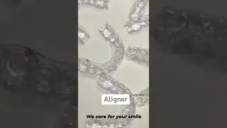 miracle aligners #aligner #dentist #smilemakeover #shortvideo #trendingaudio #youtubeshorts #dental
