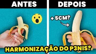 HARMONIZAÇÃO P3NIANA? Biomedico Especialista Explica TUDO sobre o Procedimento | GLOW UP MASCULINO