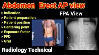 Abdomen Erect AP view # Abdomen radiography #   Part -2 # FPA view # By BL Kumawat #