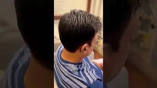 No More Balding | Non-Surgical Hair patching | 100% Human hair #hairsolution #hairreplacement