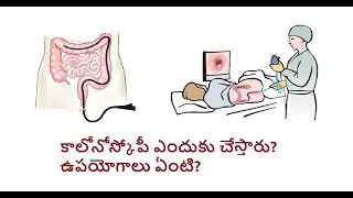 కాలోనోస్కోపీ I Colonoscopy Benefits - Dr K S Soma Sekhar Rao