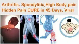 Arthritis | Spondylitis | High Body Pain Cure in 45 days | Hidden Pain | Viral | Dr Shalini