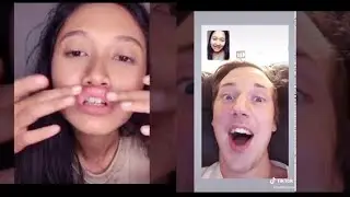 Lip Filler Prank Part 2||Tik Tok Trend