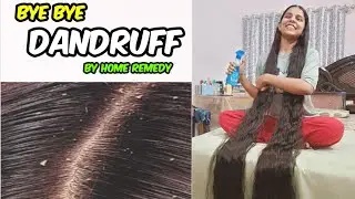 Home Remedy For Treating Dandruff ll How To Treat Dandruff At Home ? Remove Dandruff ll Anjali care