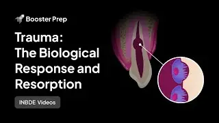 Endodontics | Trauma - The Biological Response and Resorption | INBDE, NDEB, ADAT