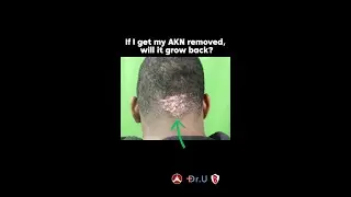 Is AKN Gone for Good? Dr. U Explains!