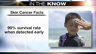 Skin Cancer Facts with FCS Medical Oncologist Sumithra Vattigunta, MD, FACP