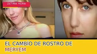el arrepentimiento de meryem uzerli: &iquest;qu&eacute; le pas&oacute; a su rostro y por qu&eacute; decidi&oacute; cambiar?