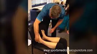 Acupuncture Intra-dermal Needling to Improve Scapular Stabilization Exercise
