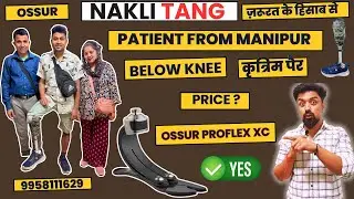 Below Knee Prosthesis | Proflex XC Cost | Best Prosthetic Foot in India| Ossur Liner | #ossur #3r80