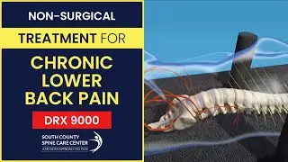 Non-Surgical Treatment for Chronic Lower Back Pain: DRX 9000 - South County Spine Care