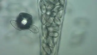 Gastroenterology. Enterobiasis. Enterobius vermicularis.