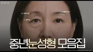 [중년눈성형 모음집]  중년수술별 케이스 모음집 l 상안검 l 눈썹하거상 l 이마거상 l 중년눈처짐해결!~