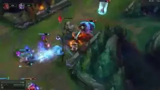 Support is so easy dude