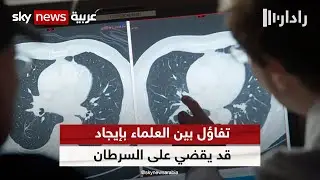 تفاؤل بين العلماء بإيجاد حل قادم من الفضاء قد يقضي على السرطان | #رادار