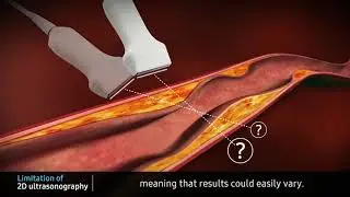 [Education] S-3D Arterial Analysis_RS80A with Prestige_Prof. Hyuk-Jae Chang