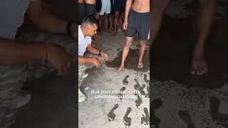 #shorts flat foot medical test #jdphysicalacademykanpur