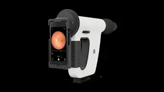 Remidio Non Mydriatic Handheld Fundus Camera demo - FOP NM