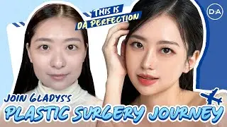 [Plastic Surgery Korea] Join Gladys's Perfect Plastic Surgery Journey 🌼